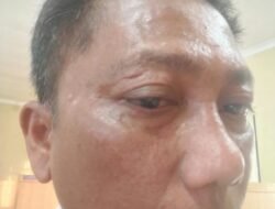 DPD PJS Sumut Desak Polisi Tangkap Pelaku Penganiayaan Wartawan di Toba
