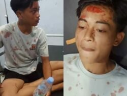 Polres Langsa di Nilai Lamban Tangani Kasus Pengeroyokan Yang Mengakibatkan Korban Trauma Berat