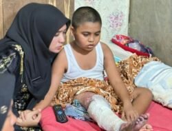 Ny. Erni Handayani Tunjukkan Kepedulian, Kunjungi Anak Korban Luka Bakar.